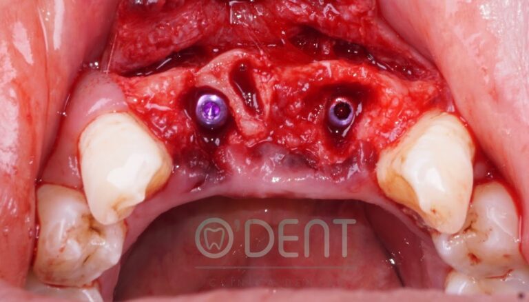 19401 odent clinica dental 768x438