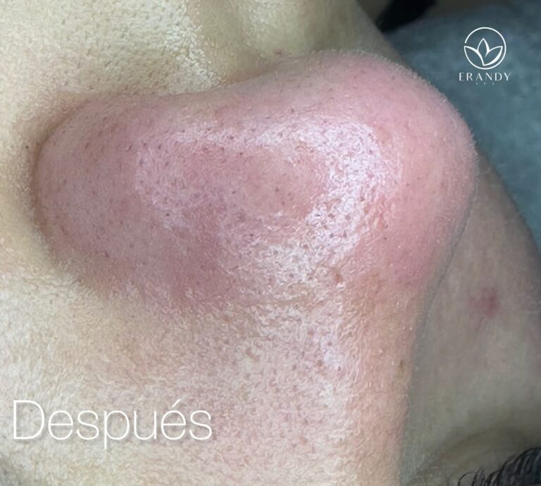 20676 erandy spa 768x690