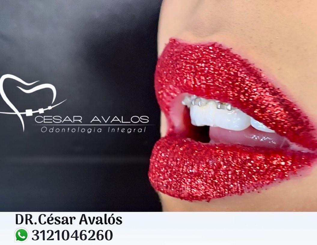 leetx-google-photo-1770169498177-2-1 leetx-google-photo-1770169498177-2-1