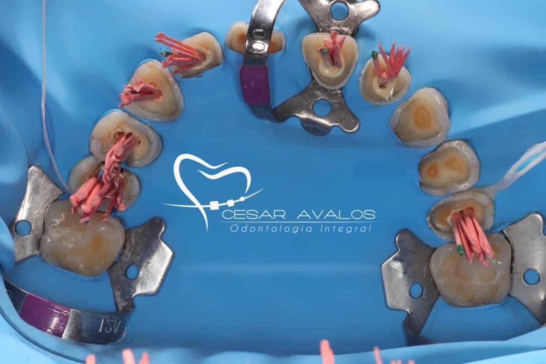 leetx-google-photo-1770169504440-5-1 leetx-google-photo-1770169504440-5-1