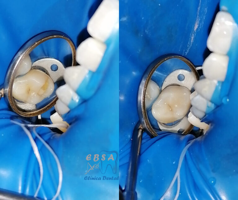 103981 ebsa dental oaxaca 768x644