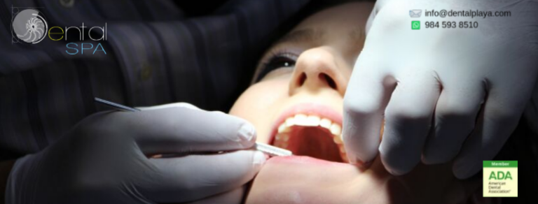 104072 dental spa playa del carmen 768x292