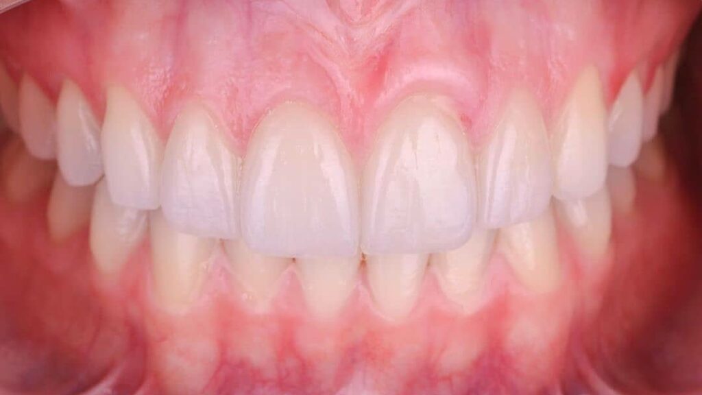 104134 dentista gustavo gaytan salim 1024x576