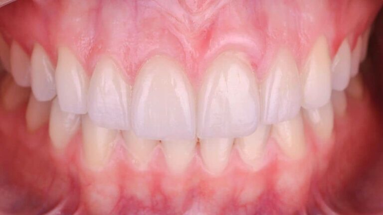104134 dentista gustavo gaytan salim 768x432